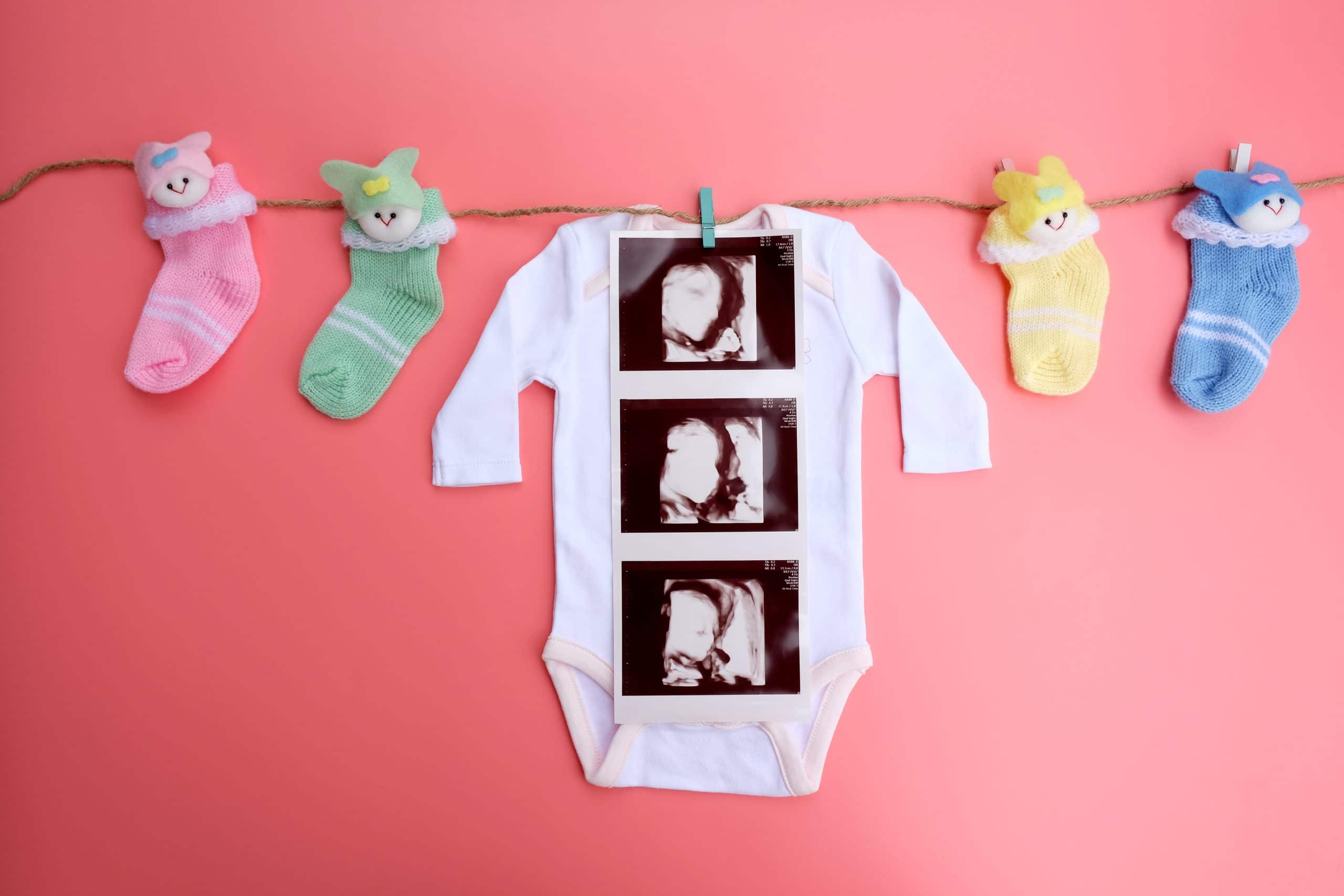 A baby onesie with a 4d ultrasound laid on top, surrounded by cute baby socks.